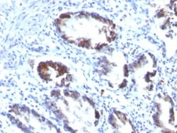 Transgelin/TAGLN/SM22 alpha Antibody (TAGLN/247), Novus Biologicals 0.2mg;